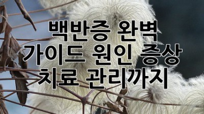 백반증 완벽 가이드: 원인, 증상, 치료, 관리까지